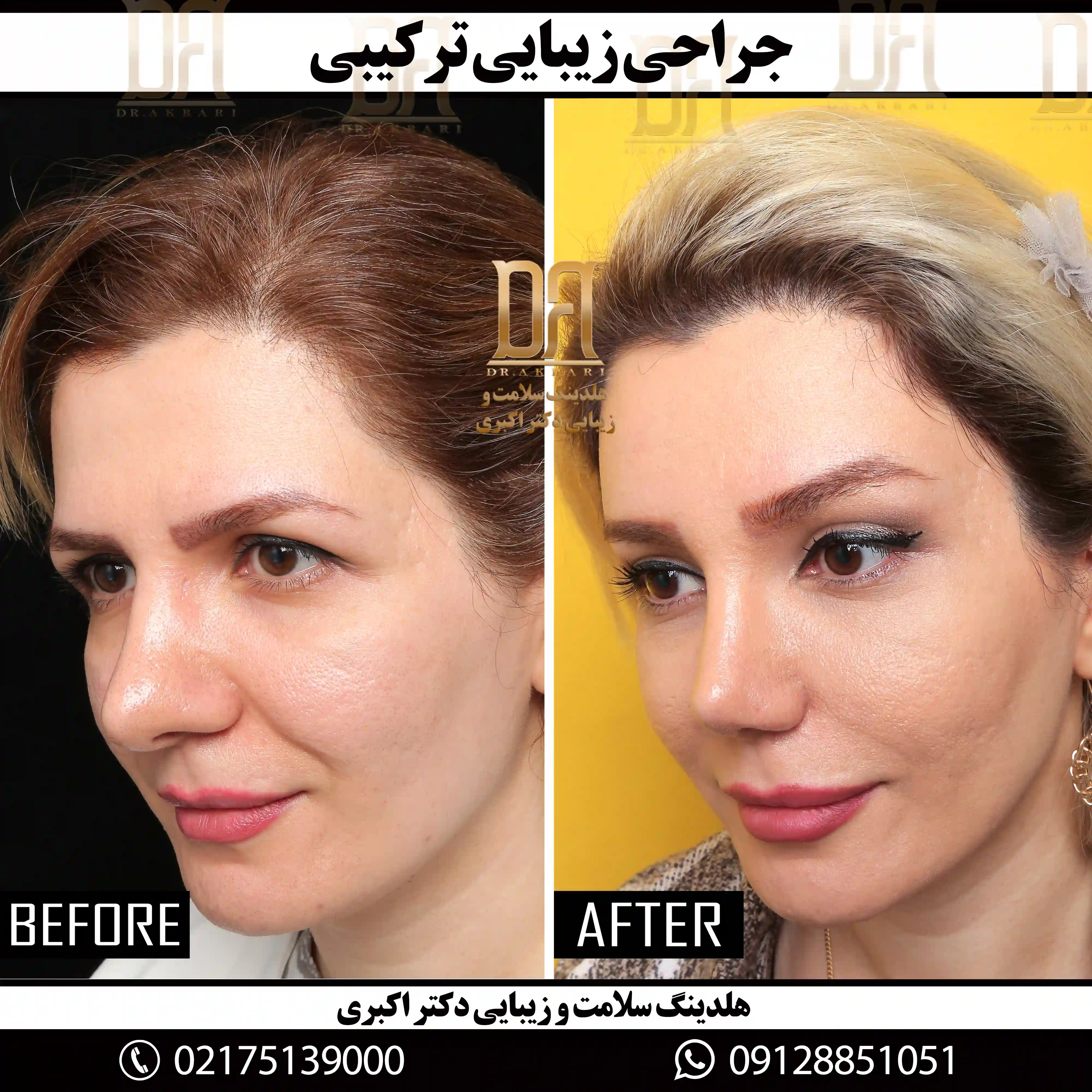 جرّاحی ناحیه صورت