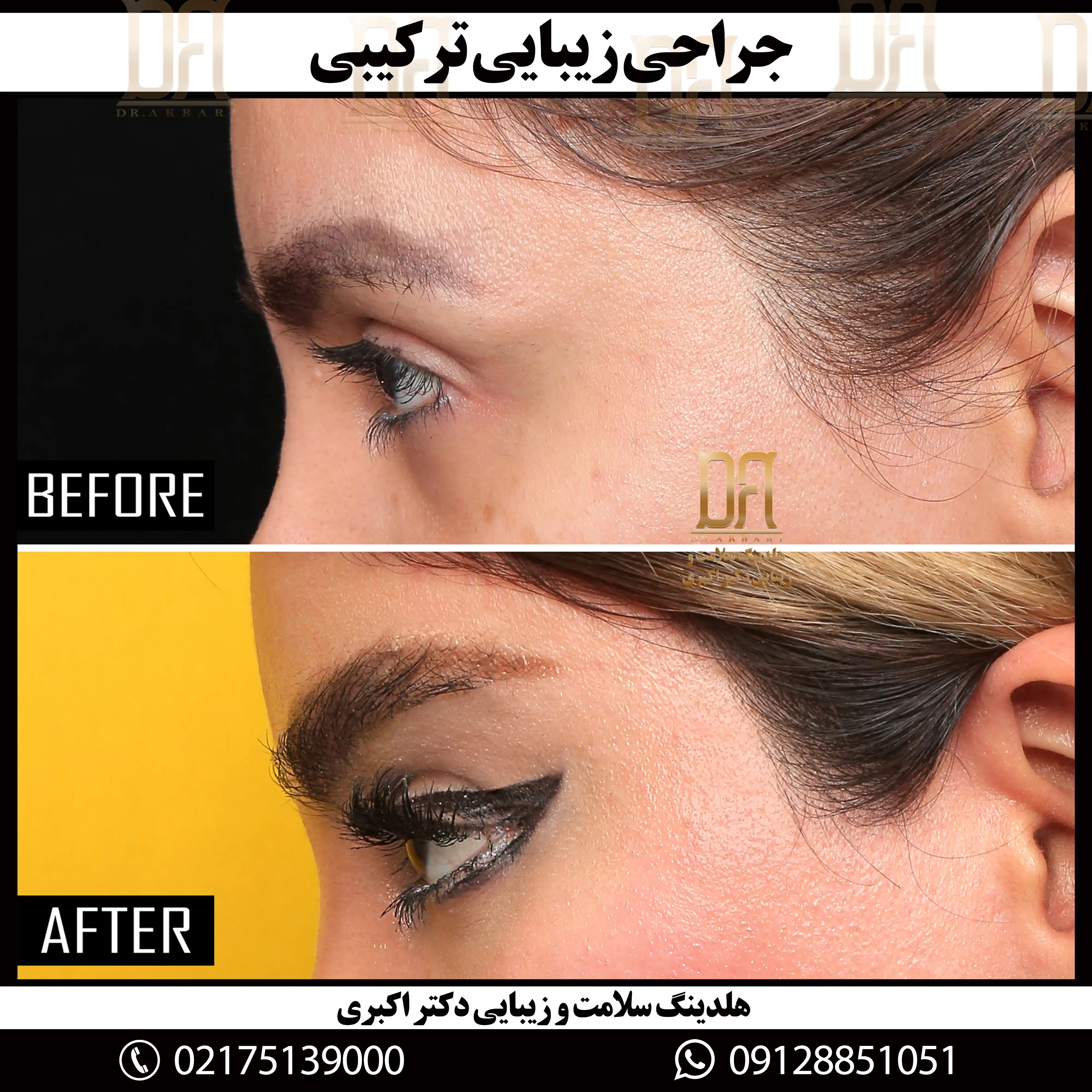 جرّاحی ناحیه صورت