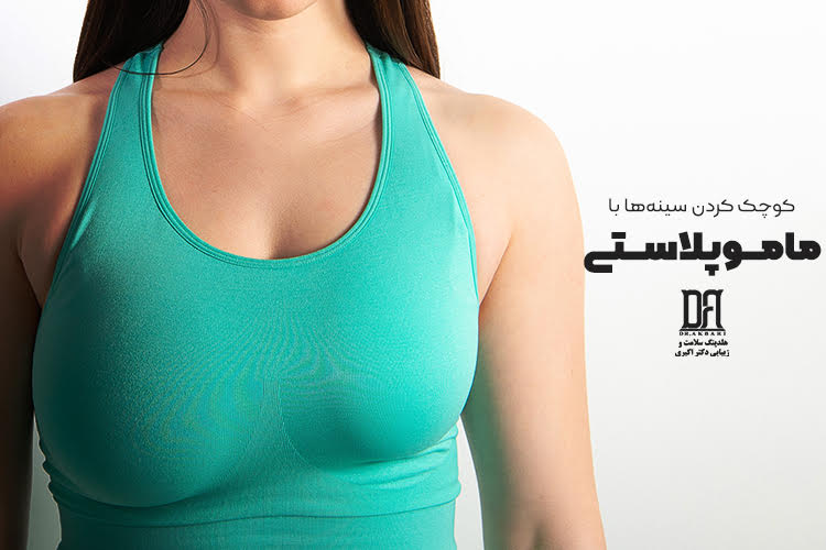 جراحی کوچک کردن سینه