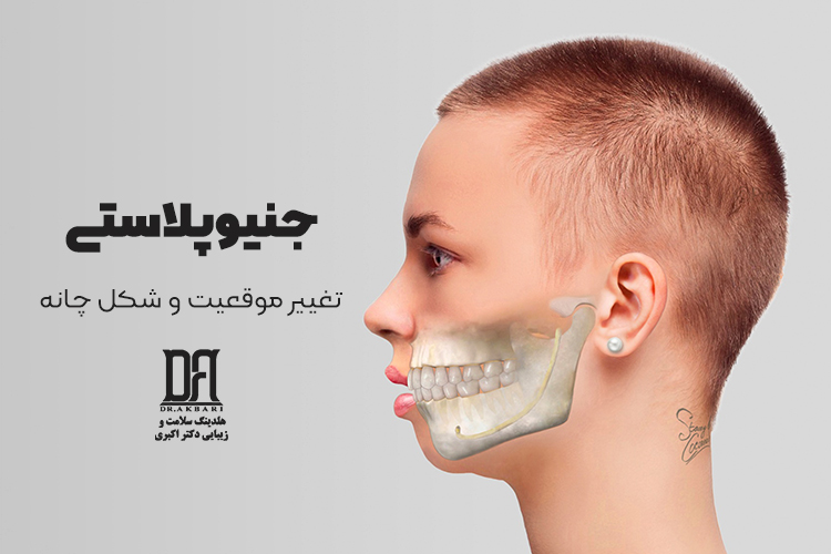 جنیوپلاستی (جراحی چانه)