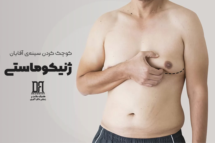ژنیکوماستی