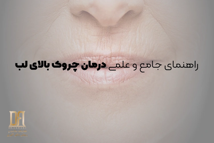 راهنمای جامع و علمی درمان چروک بالای لب برای افراد ۵۰ سال به بالا