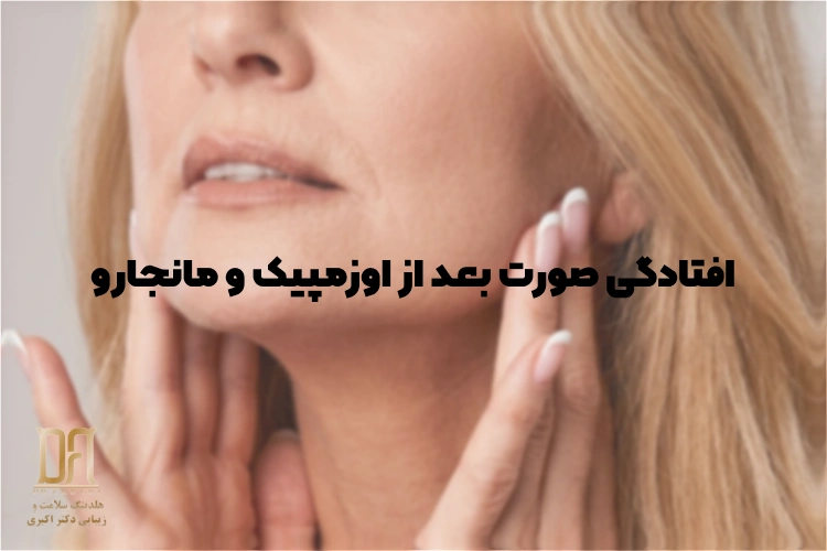 افتادگی صورت بعد از اوزمپیک و مانجارو؛ بهترین درمان با لیفت سوپریم