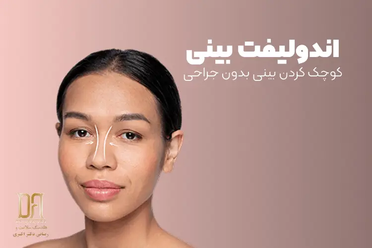 اندولیفت بینی؛ راهی برای کوچک کردن بینی بدون جراحی