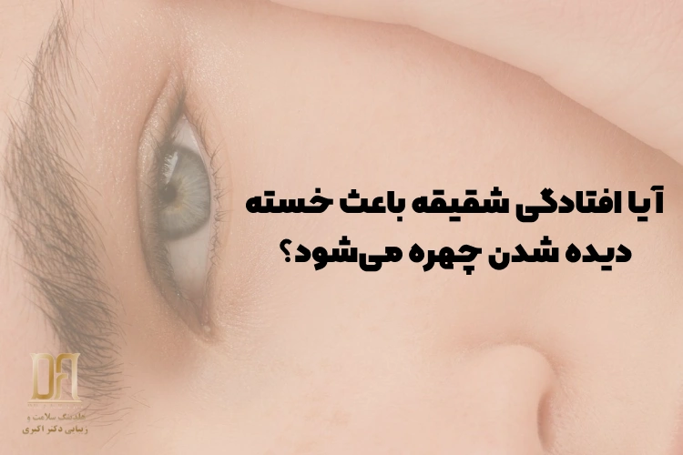 آیا افتادگی شقیقه باعث خسته دیده شدن چهره می‌شود؟ بررسی علمی تاثیر شقیقه بر فرم صورت و حالت چشم