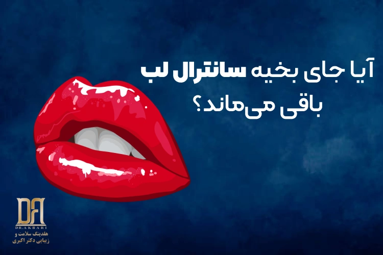 آیا جای بخیه سانترال لب باقی می‌ماند؟ (بررسی عوارض و واقعیت‌ها)