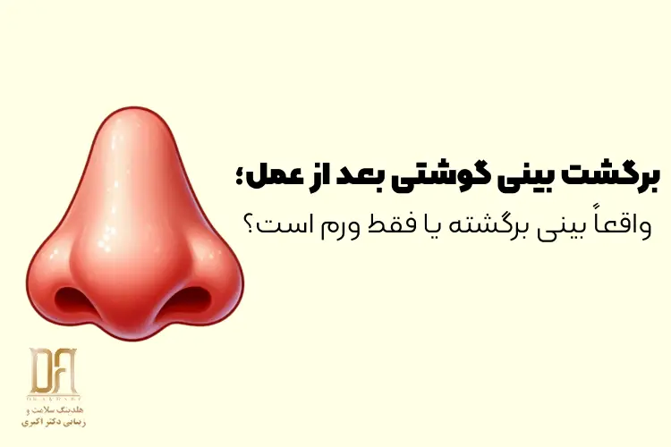 برگشت بینی گوشتی بعد از عمل؛ واقعاً بینی برگشته یا فقط ورم است؟