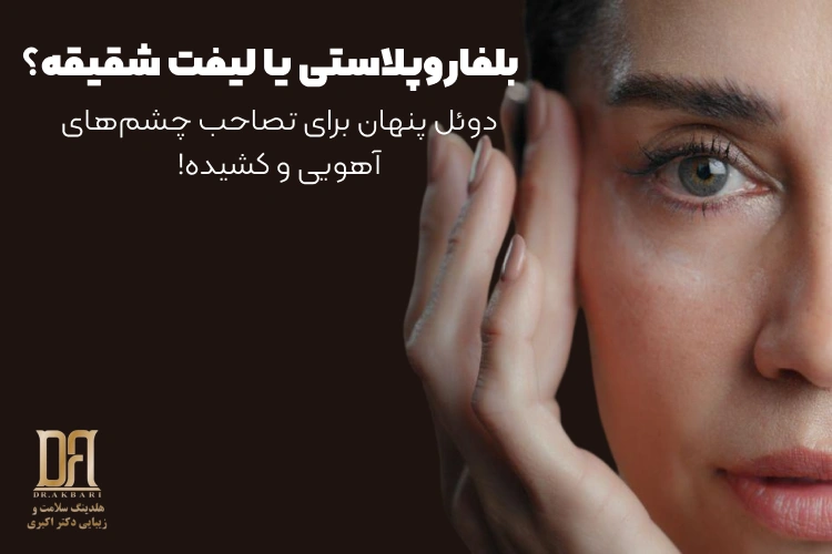 بلفاروپلاستی یا لیفت شقیقه؟ دوئل پنهان برای تصاحب چشم‌های آهویی و کشیده!