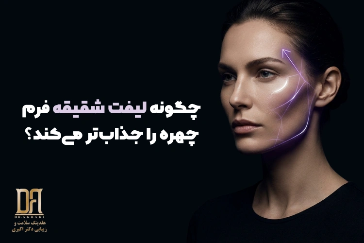 تاثیر لیفت شقیقه روی زاویه‌سازی صورت | چگونه لیفت شقیقه فرم چهره را جذاب‌تر می‌کند؟