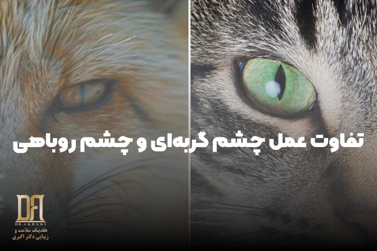 عمل چشم گربه‌ای یا چشم روباهی؟ تفاوت‌ها، بهترین روش‌ها و هر آنچه باید قبل از تصمیم‌گیری بدانید