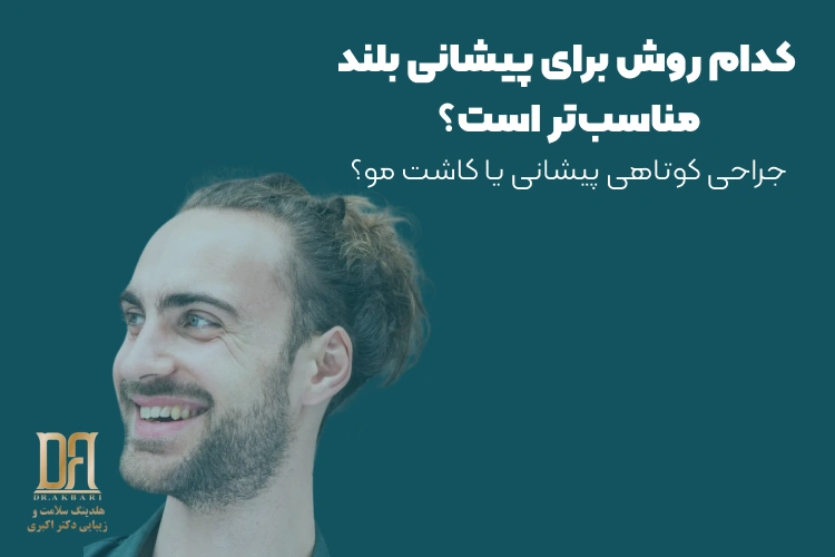 جراحی کوتاهی پیشانی یا کاشت مو؛ کدام روش برای پیشانی بلند مناسب‌تر است؟