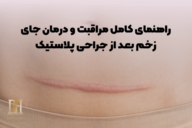 از بخیه تا اسکار ظریف؛ راهنمای کامل مراقبت و درمان جای زخم بعد از جراحی پلاستیک
