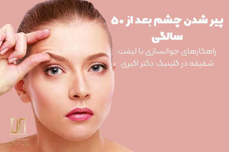 پیر شدن چشم بعد از ۵۰ سالگی | راهکارهای جوانسازی با لیفت شقیقه در کلینیک دکتر اکبری