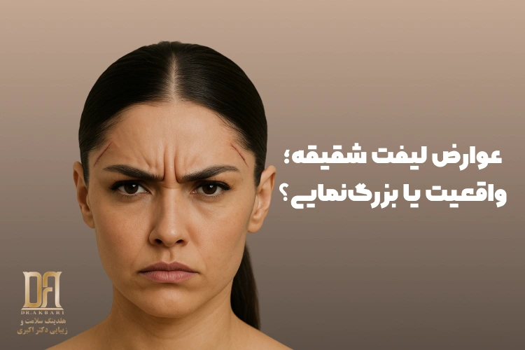 عوارض لیفت شقیقه؛ واقعیت یا بزرگ‌نمایی؟