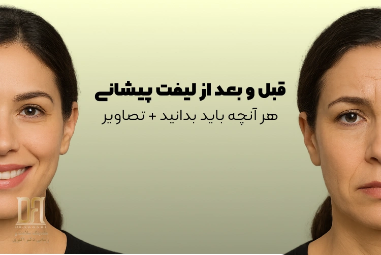 لیفت پیشانی؛ از راز جوانی تا انتخاب بهترین کلینیک زیبایی در فرمانیه
