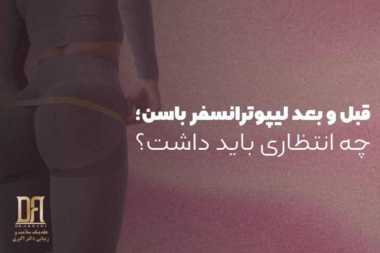 قبل و بعد لیپوترانسفر باسن؛ چه انتظاری باید داشت؟