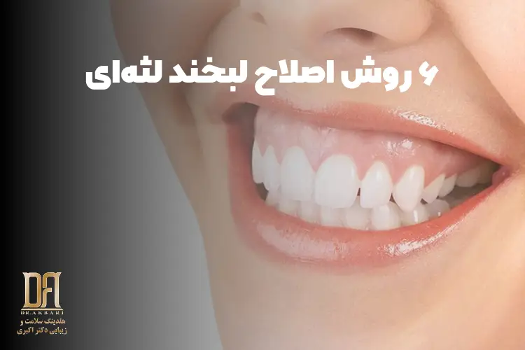 لبخند لثه‌ای چیست؟ ۶ روش اصلاح لبخند لثه‌ای و انتخاب درمان مناسب