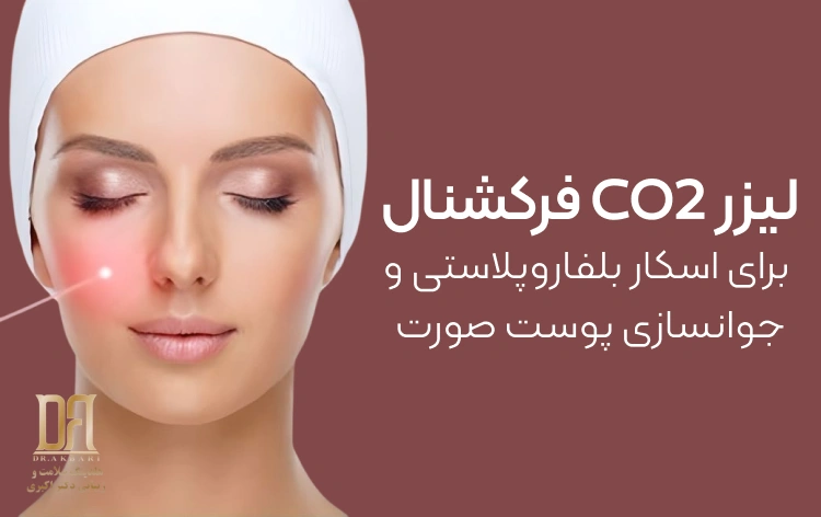 لیزر CO2 فرکشنال برای اسکار بلفاروپلاستی و جوانسازی پوست صورت
