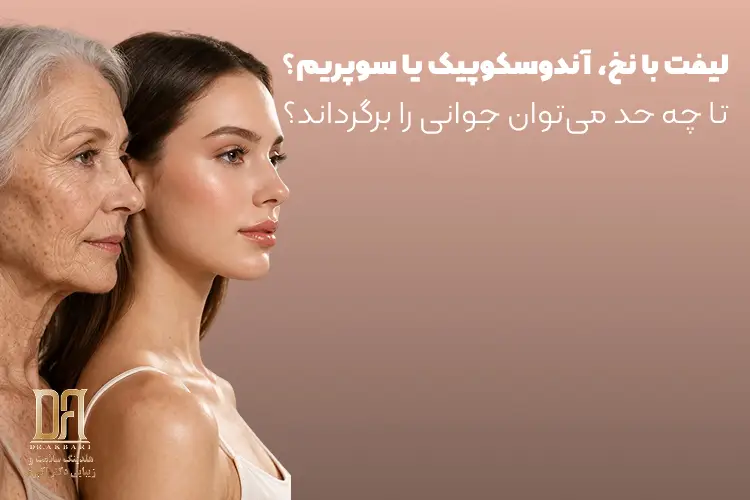 لیفت با نخ، آندوسکوپیک یا سوپریم؟ مقایسه‌ای که نتیجه را کاملاً تغییر می‌دهد