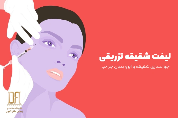 لیفت شقیقه تزریقی؛ جوانسازی شقیقه و ابرو بدون جراحی