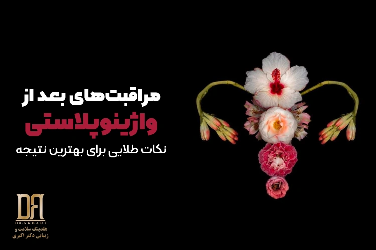 مراقبت‌های بعد از واژینوپلاستی + نکات طلایی برای بهترین نتیجه (راهنمای فوق‌جامع و علمی)