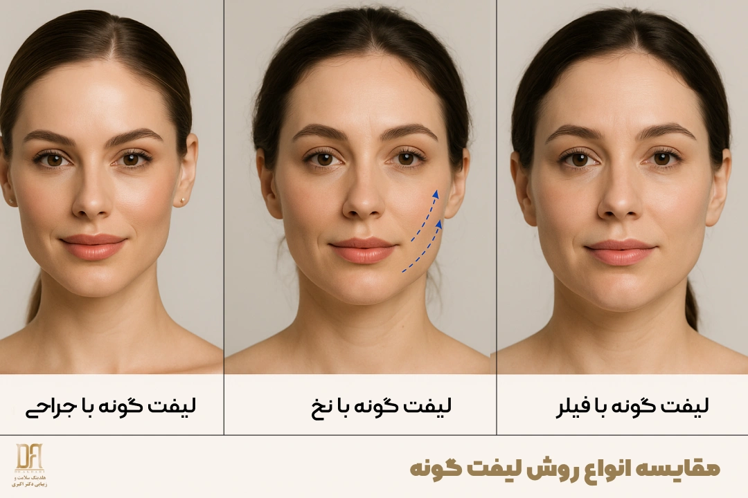 مقایسه انواع روش لیفت گونه در تهران