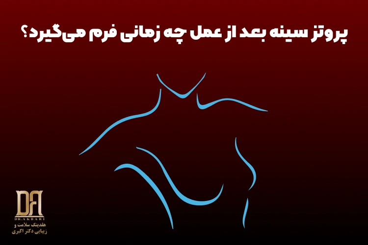 پروتز سینه بعد از عمل چه زمانی فرم می‌گیرد؟ از بالا بودن پروتز تا نتیجه نهایی
