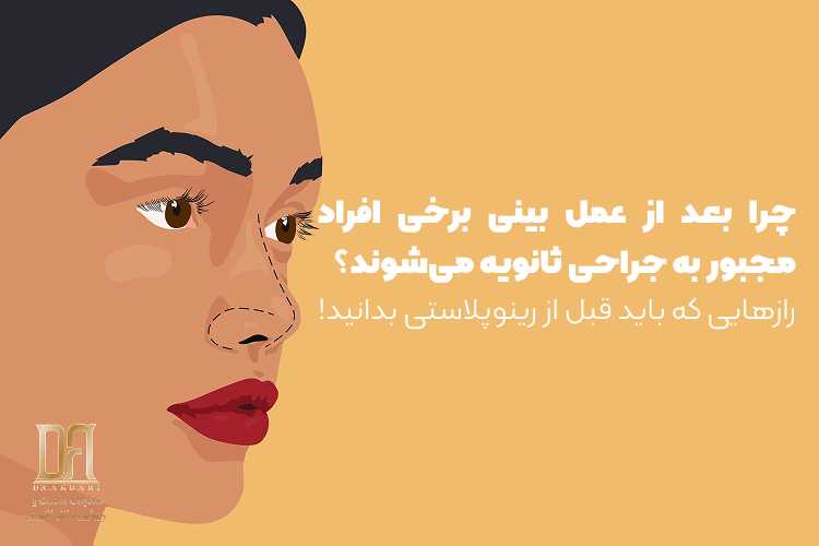 چرا بعد از عمل بینی برخی افراد مجبور به جراحی ثانویه می‌شوند؟ رازهایی که باید قبل از رینوپلاستی بدانید!