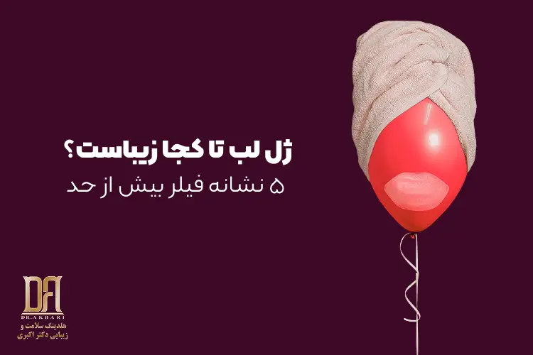 ژل لب تا کجا زیباست؟ مرز باریک بین لب جذاب و لب بیش از حد
