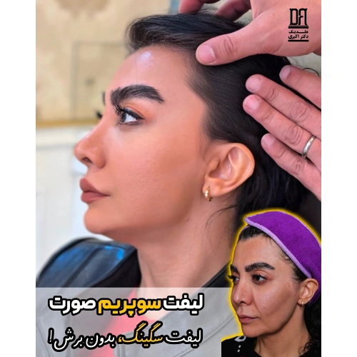 لیفت سوپریم صورت | لیفت سگینگ بدون برش