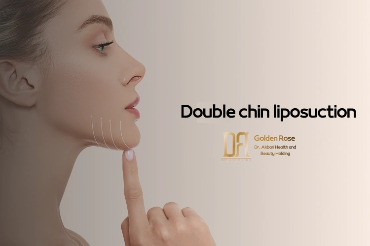 Double chin liposuction