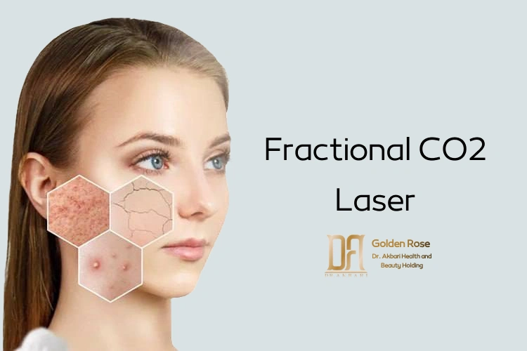 Fractional CO2 Laser