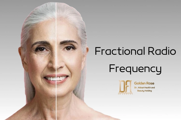 Fractional Radio Frequency