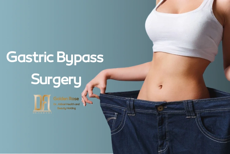 Gastric Bypass Surgery