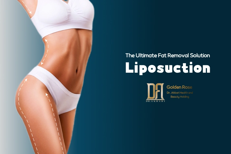 Liposuction