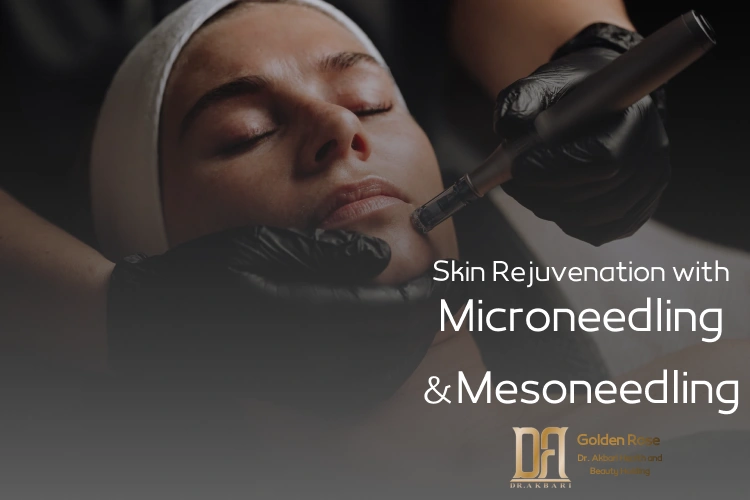 Microneedling and Mesoneedling