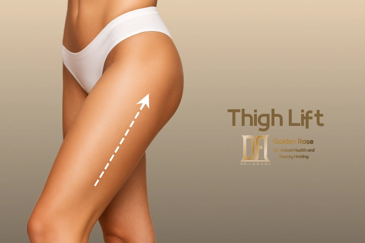 Thigh Lift