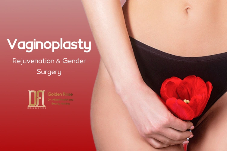 Vaginoplasty