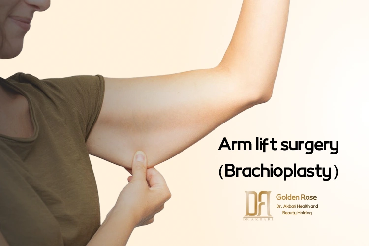 Arm lift surgery (brachioplasty)