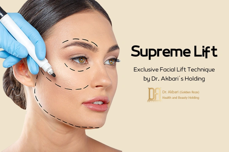 Supreme Lift