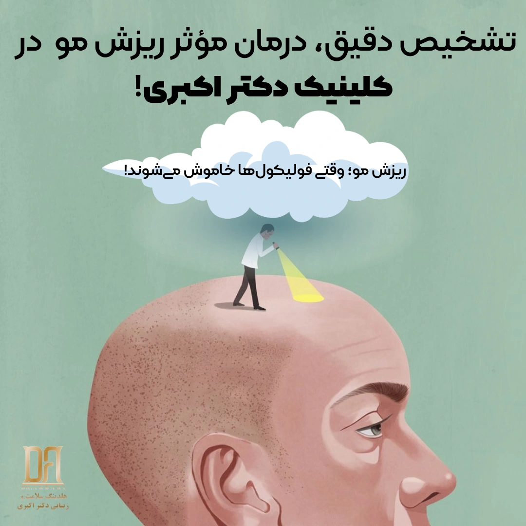 بررسی ریزش مو در ناحیه جلوی سر توسط متخصص در کلینیک دکتر اکبری