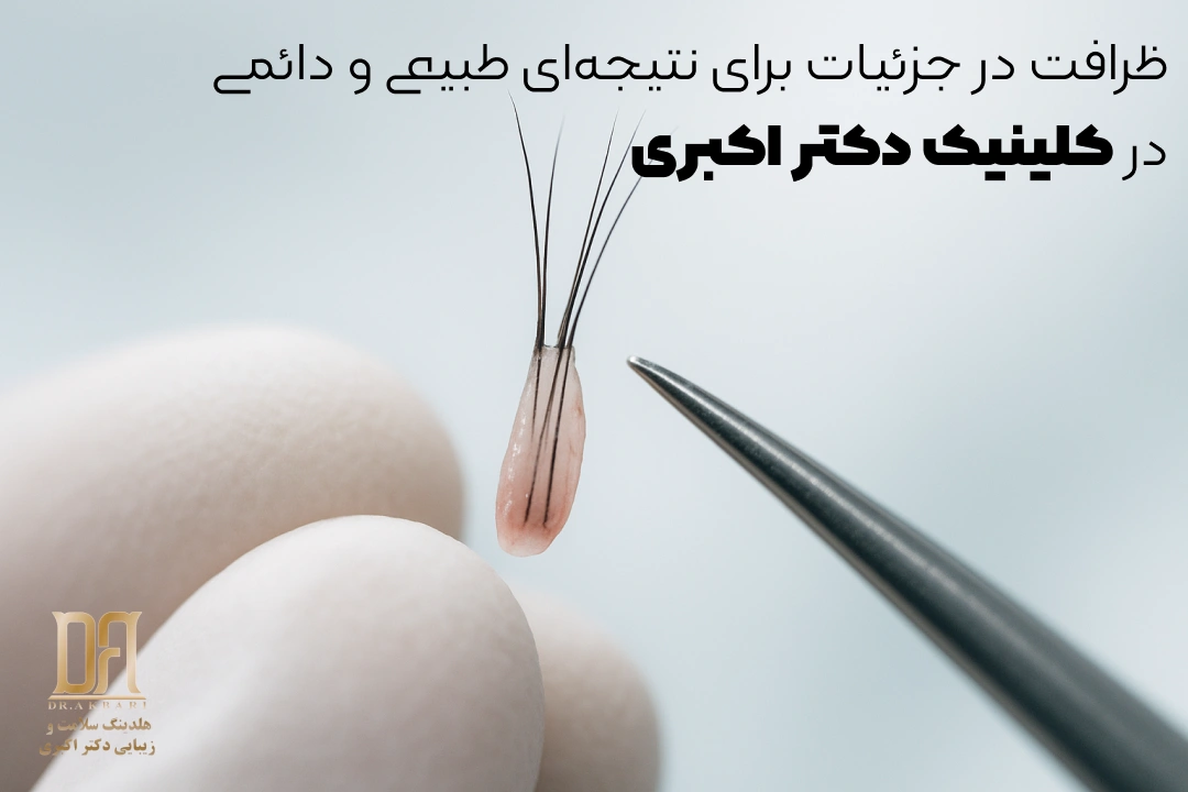 کاشت ابرو حرفه‌ای با گرافت‌های طبیعی در کلینیک دکتر اکبری