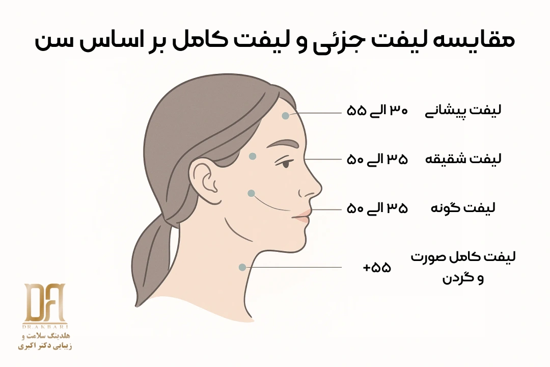 سن مناسب برای لیفت صورت: بررسی نواحی گونه، شقیقه، پیشانی و گردن و تعیین بهترین روش بین لیفت جزئی و لیفت کامل