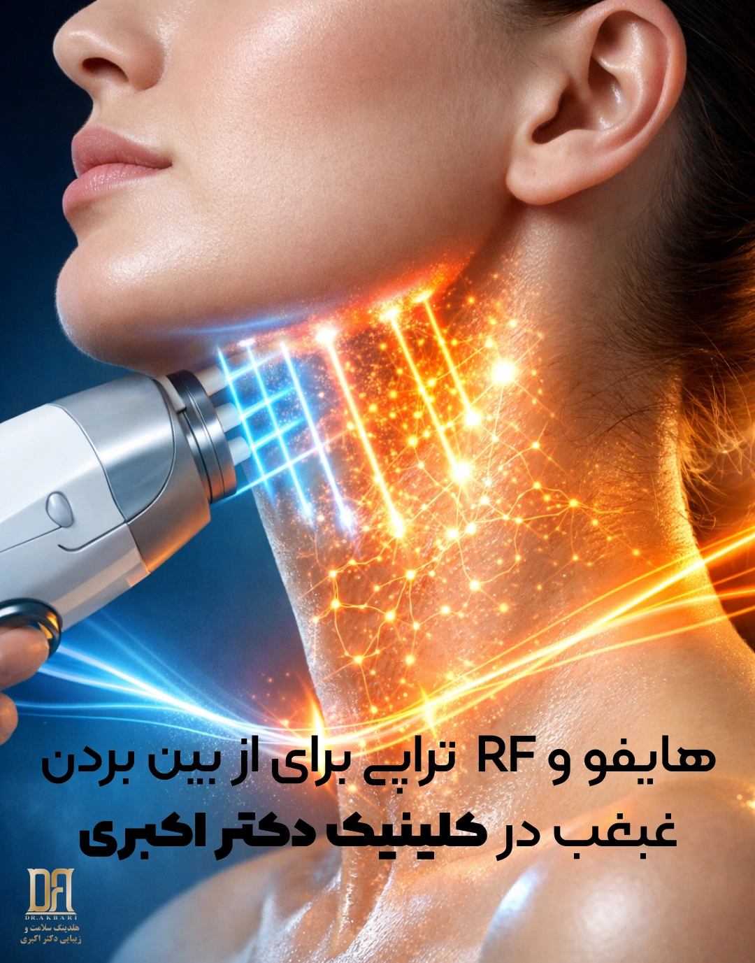 هایفوتراپی و آر اف تراپی برای از بین بردن غبغب به روش غیر تهاجمی در کلینیک دکتر اکبری