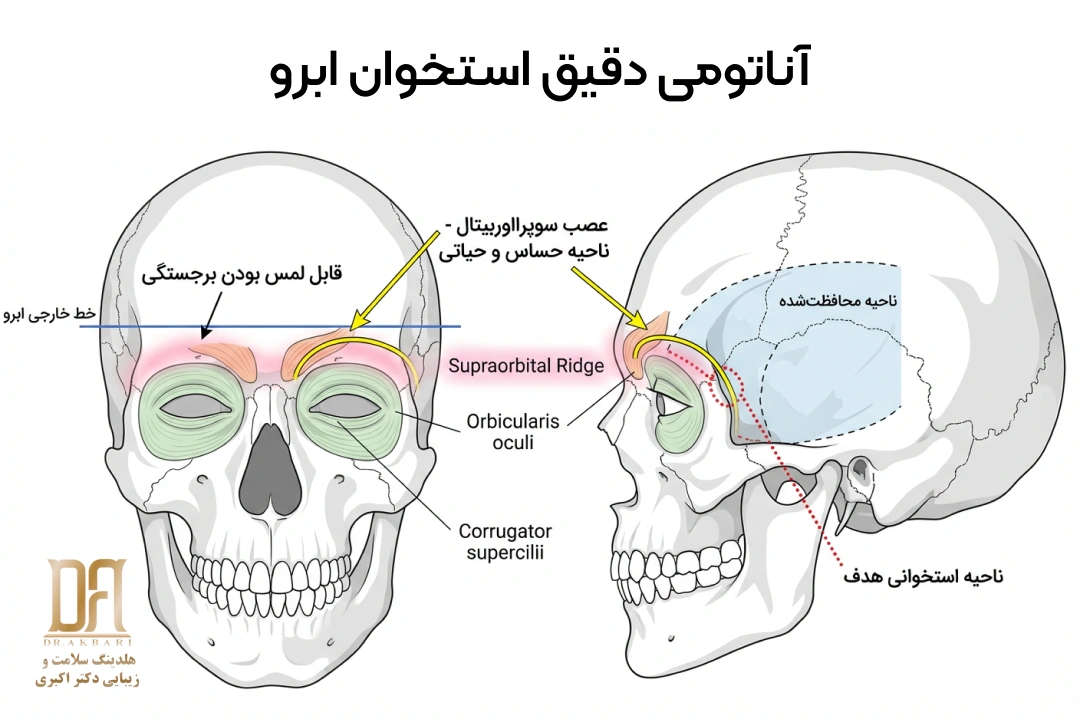 نمای آناتومیک برجستگی استخوان ابرو (Supraorbital Ridge) و عضلات و عصب‌های اطراف؛ تمرکز جراحی تراش تنها روی استخوان و محافظت از نواحی حساس.