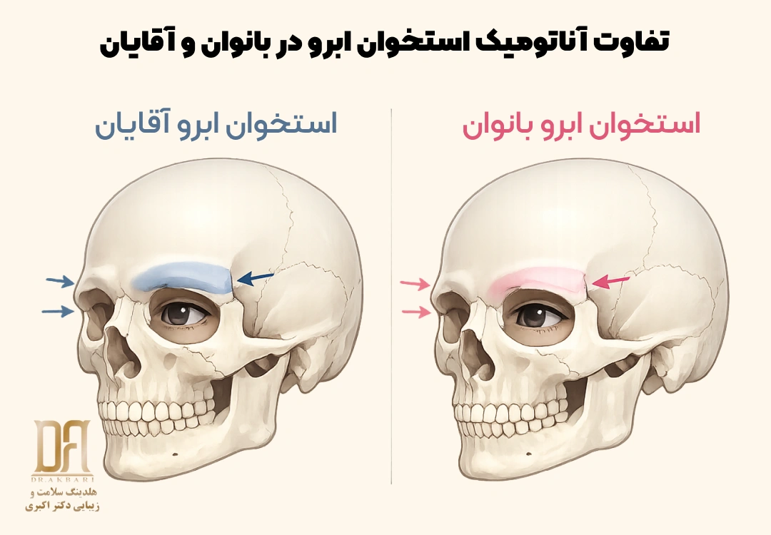 نمای آناتومیک Supraorbital Ridge در مردان و زنان؛ برجستگی استخوانی زیر ابرو در مردان باعث عقب‌تر و گودتر دیده شدن چشم‌ها می‌شود، در حالی که پیشانی زنان صاف یا با انحنای ملایم است.