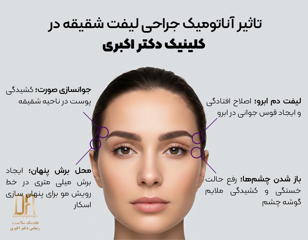 تاثیر لیفت شقیقه کلینیک دکتر اکبری بر صورت و چشم‌ها که باعث جوانسازی صورت و جذابیت چشم‌ها می‌شود.