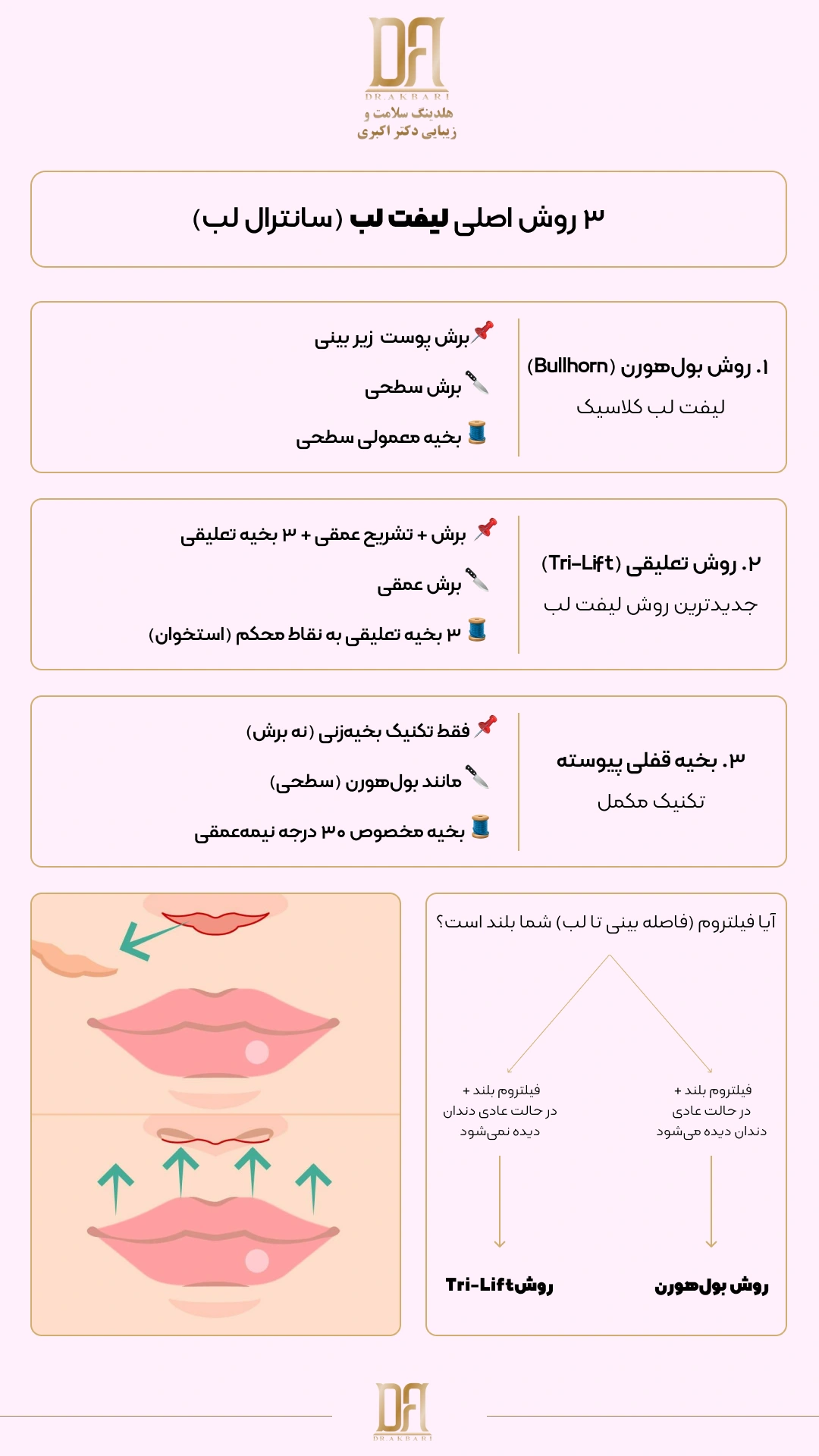 ینفوگرافیک راهنمای انتخاب روش لیفت لب یا سانترال لب بر اساس آناتومی دهان و فیلتروم هلدینگ دکتر اکبری