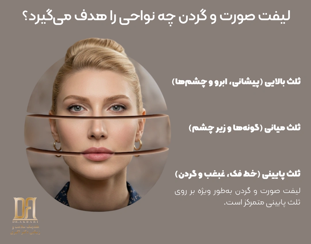 تصویر شماتیک نواحی تحت درمان در لیفت صورت و گردن شامل ناحیه فک، غبغب، چین‌های عمیق دور دهان و پوست گردن | هلدینگ دکتر اکبری
