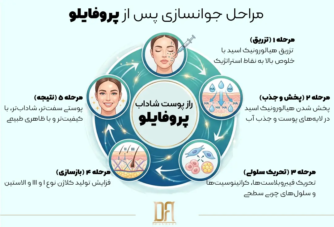 اینفوگرافیک چرخه عملکرد پروفایلو: تزریق هیالورونیک اسید، پخش در پوست، تحریک فیبروبلاست‌ها، بازسازی کلاژن و الاستین، و نتیجه پوستی سفت و شاداب.